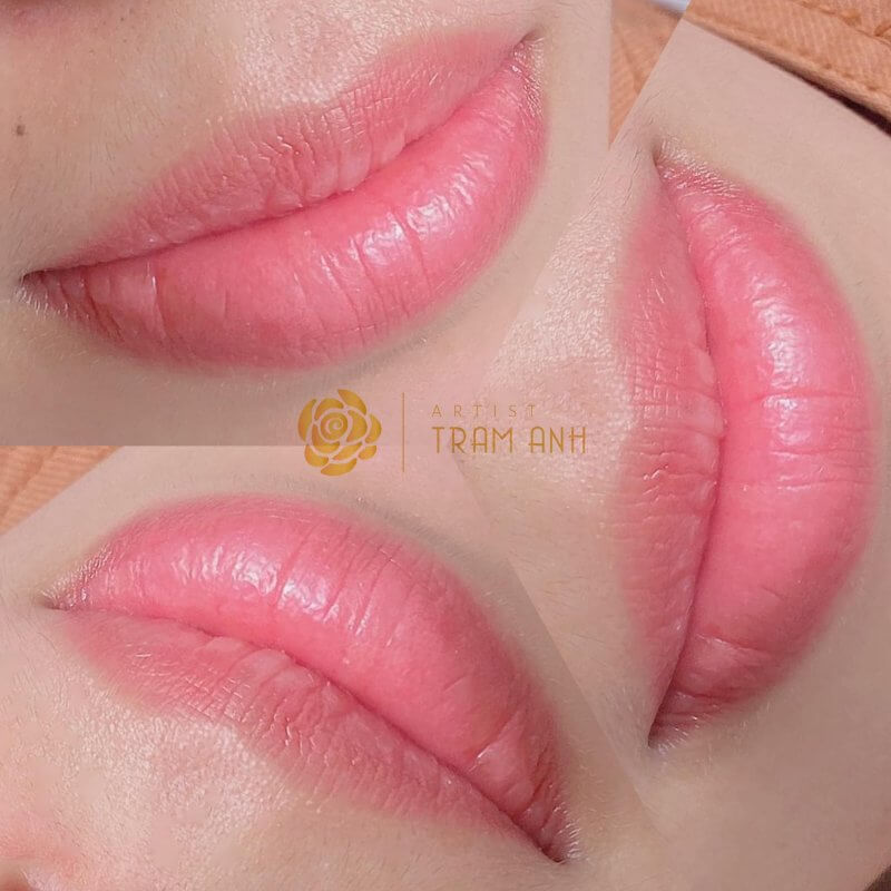 Cấp độ thâm môi và sự thật về khử môi thâm 3 HTBA khu tham moi 01