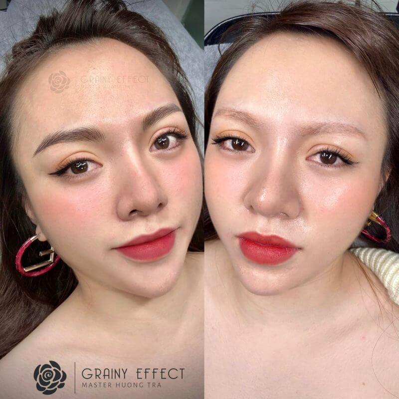 Sẹo, trổ màu, da dầu có thực hiện điêu khắc chân mày được không? 3 HTBA seo tro mau da dau co thuc hien dieu khac chan may duoc khong 04